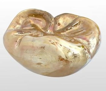 Gold Tooth